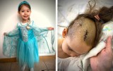 Mała Lili walczy o życie. Zdiagnozowano nowotwór złośliwy mózgu. Potrzeba ogromnych pieniędzy [ZBIÓRKA]