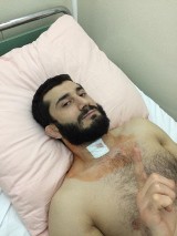 Mamed Khalidov miał operację kręgosłupa