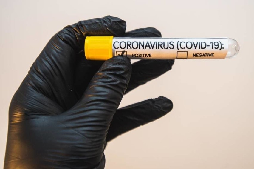 Koronawirus. Niższa liczba zakażonych nie oznacza spadku zachorowań na COVID-19