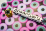 Koronawirus. Dwa kolejne przypadki zakażenia w powiecie czarnkowsko-trzcianeckim