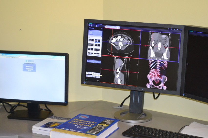 Sosnowiec: Szpital Miejski wzbogacił się o nowoczesny tomograf [ZDJĘCIA i WIDEO]