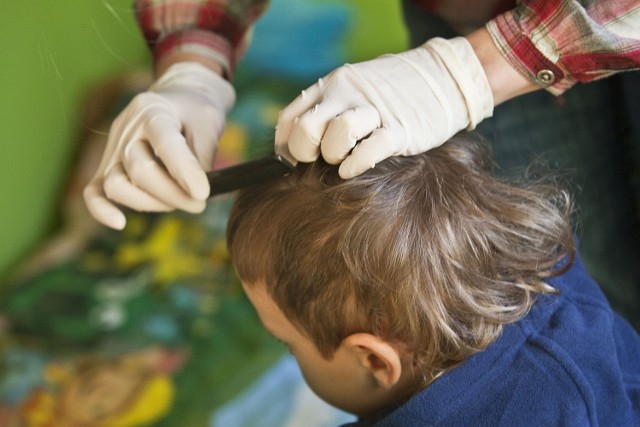 W szkołach, gdzie rodzice wyrażają zgodę na sprawdzanie dzieciom głów, problem wszawicy udaje się zdusić w zarodku. Gorzej, jeśli rodzice nie reagują na tę chorobę pasożytniczą