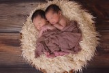 W Gdańsku urodziły się bliźnięta syjamskie – były „wielkim cudem”. Kim są bliźnięta syjamskie i jak wygląda ich leczenie?