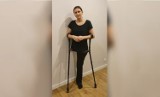 Lekarka z Bydgoszczy pokonała nowotwór, ale straciła nogę. Trwa zbiórka na protezę