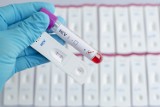 Bezpłatne badanie przeciwciał anty-HCV możliwe od 1 lipca. Kto może wykonać na koszt NFZ test na wirusowe zapalenie wątroby typu C?