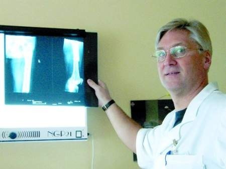 Andrzej Mrowiec, ordynator Chirurgii Urazowo--Ortopedycznej w SCM w Polanicy stosuje nowoczesną metodę leczenia złamań już od roku.
