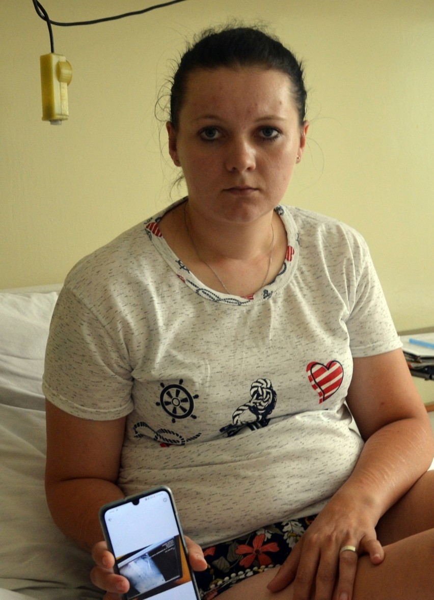Lekarze z Bełchatowa wyjęli kleszcze chirurgiczne z brzucha pacjentki. Nosiła je tam dwa lata