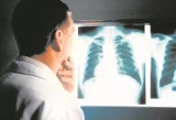 ZDROWIE: Chorobie płuc możesz zapobiec wcześniej 