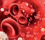 Światowy Dzień Hemofili: Ta choroba występuje głównie u mężczyzn