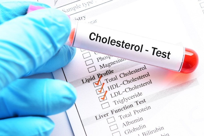 Badanie sprawdzające poziom obydwu frakcji cholesterolu oraz...