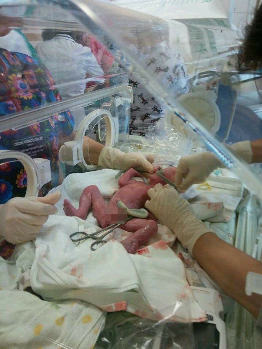 W ostrowskim szpitalu urodziły się trojaczki [FOTO]
