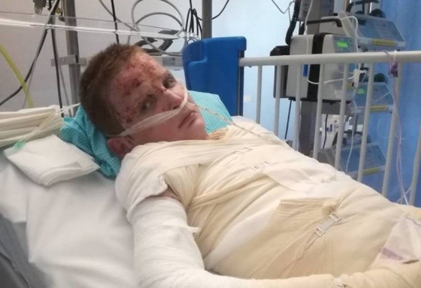 Odszedł 13-letni Jaś, który odniósł ciężkie obrażenia w pożarze kamienicy na Pileckiego