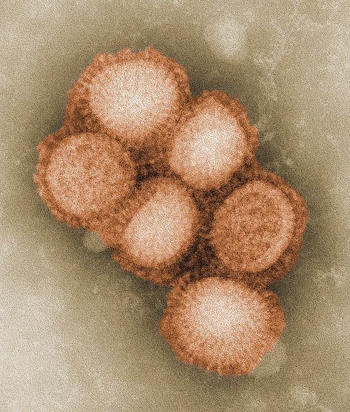 Źródło: http://commons.wikimedia.org/wiki/File:CDC-11214-swine-flu.jpg