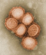Świńska grypa w natarciu