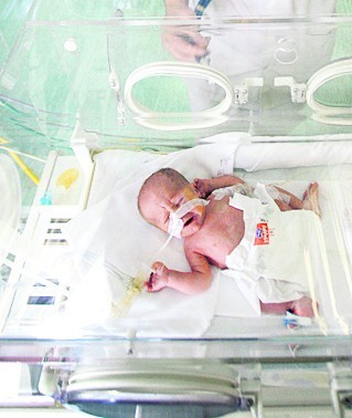 Oddział neonatologiczny ma coraz lepszy sprzęt