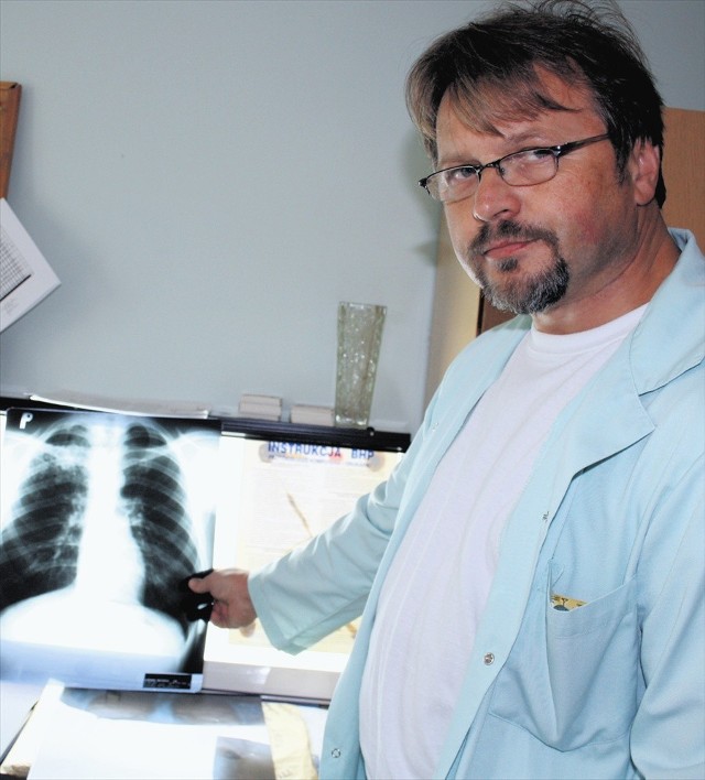 Pulmonolog Krzysztof Barczyk pokazuje, jak wyglądają płuca osoby chorej na gruźlicę