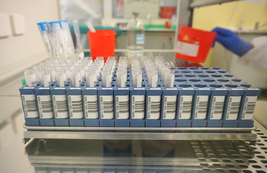 Testy na koronawirusa są już wykonywane w całej Polsce.