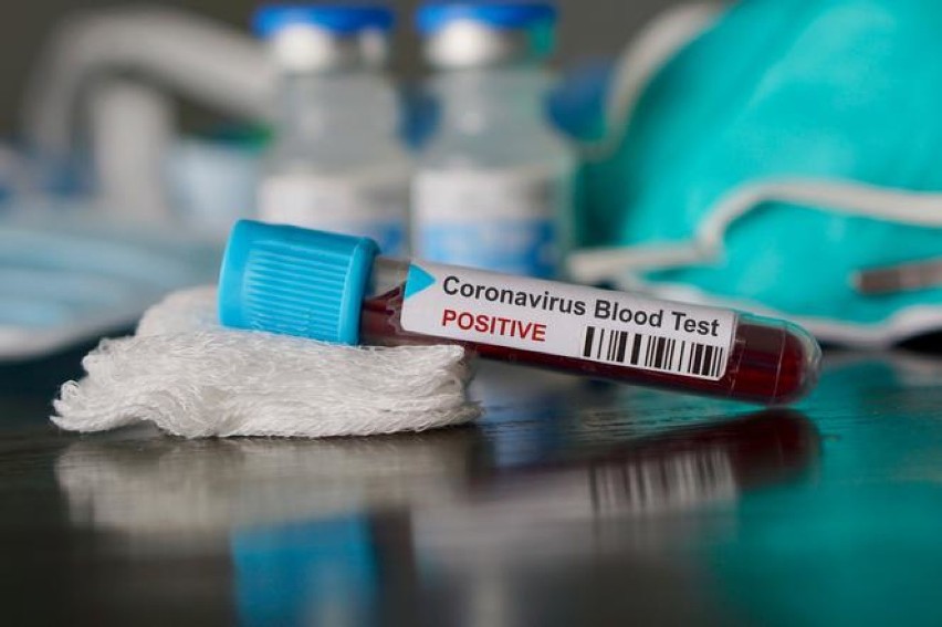 Wyniki badań laboratoryjnych potwierdziły zakażenie koronawirusem u 1 osoby z powiatu pleszewskiego