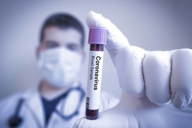 Dane statystyczne dotyczące pandemii koronawirusa w poniedziałek, 14 lutego 2022 roku.