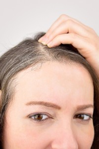 Wczesne siwienie może być oznaką choroby. Jakie choroby widać na włosach?