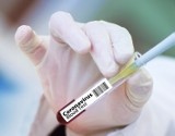 Koronawirus: Zmarł ochotnik uczestniczący w testach szczepionki AstraZeneca. Był Brazylijczykiem
