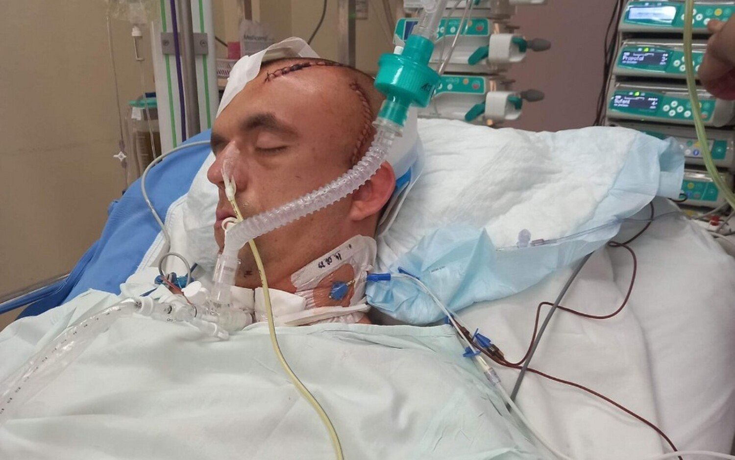 En un día perdió la salud.  Mateusz Augustinjak de Leszno necesita ayuda