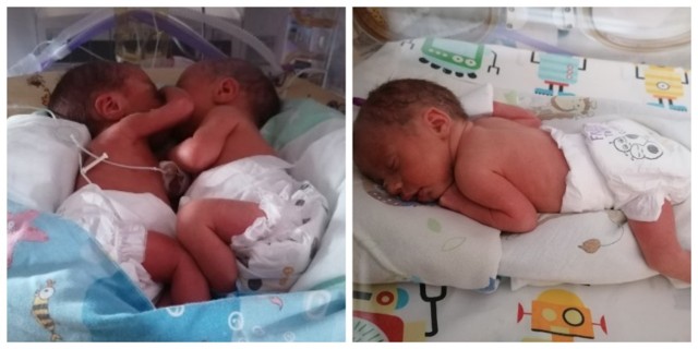 W Szpitalu Miejskim w Rudzie Śląskiej 17.10 2020 urodziły się kolejne trojaczki. To dziewczynka i dwóch chłopców.

Zobacz kolejne zdjęcia. Przesuwaj zdjęcia w prawo - naciśnij strzałkę lub przycisk NASTĘPNE