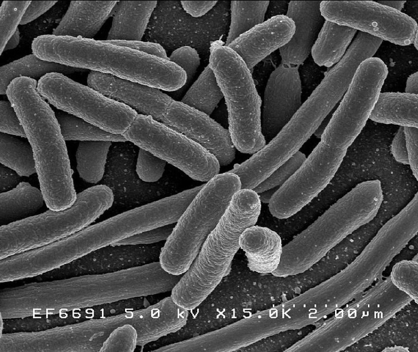 Pałeczki okrężnicy (Escherichia coli)

O ile bakterie...