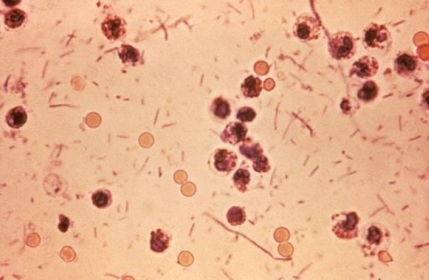 Shigella

To kolejna bakteria, która może nam uprzykrzyć...