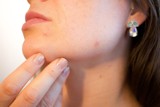To dzieje się z Twoja skórą, jeśli nie zmywasz makijażu na noc! Co mówi dermatolog? 