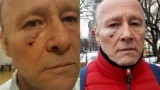 Pieczyński pobity w centrum Warszawy. Aktor publikuje szokujący komentarz [ZDJĘCIA]