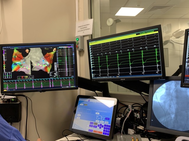 Dzięki elektroanatomicznemu systemowi 3D na ekranach komputerów, wyposażonych w odpowiednie oprogramowanie, pojawiają się kolorowe obrazy, przedstawiające serce w przestrzeni trójwymiarowej, z nałożonymi mapami jego czynności elektrycznych .