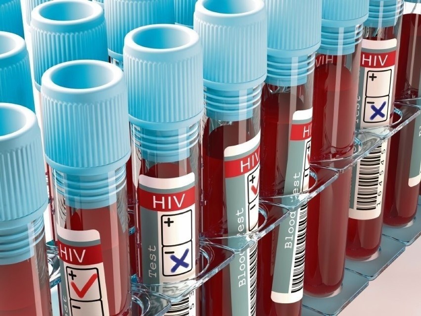 W Łodzi statystyki zakażeń wirusem HIV wzrosły aż...