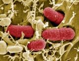 Bełchatów: pacjentka z podejrzeniem z E.coli