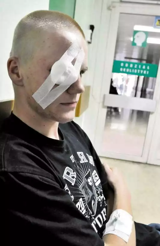 Michał stracił oko w zamieszkach kibiców z policją. Musi zrezygnować z niektórych pasji