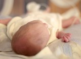 Szpital Konopnickiej zapłaci za poparzenie noworodka