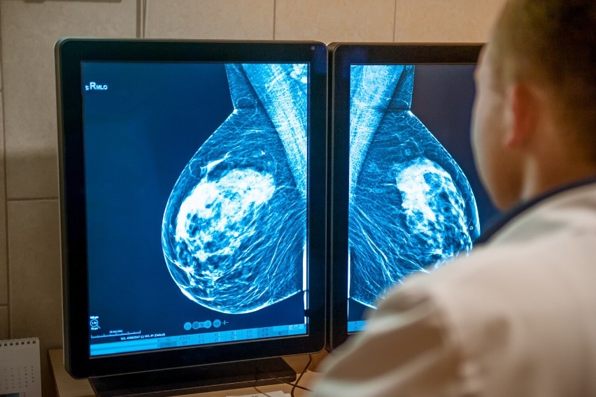 Zaawansowany rak piersi prowadzi do powstawania odległych...