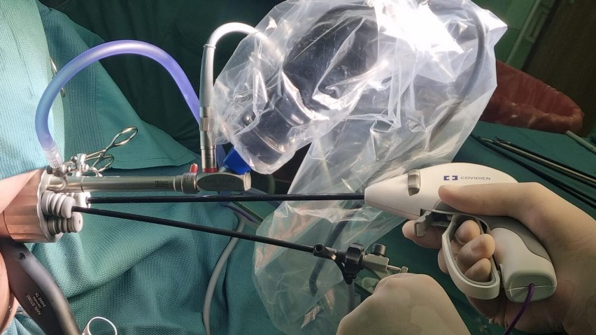 Pierwszy taki zabieg w historii kaliskiego szpitala. Chirurdzy usunęli guza odbytnicy z pomocą nowoczesnej technologii. ZDJĘCIA