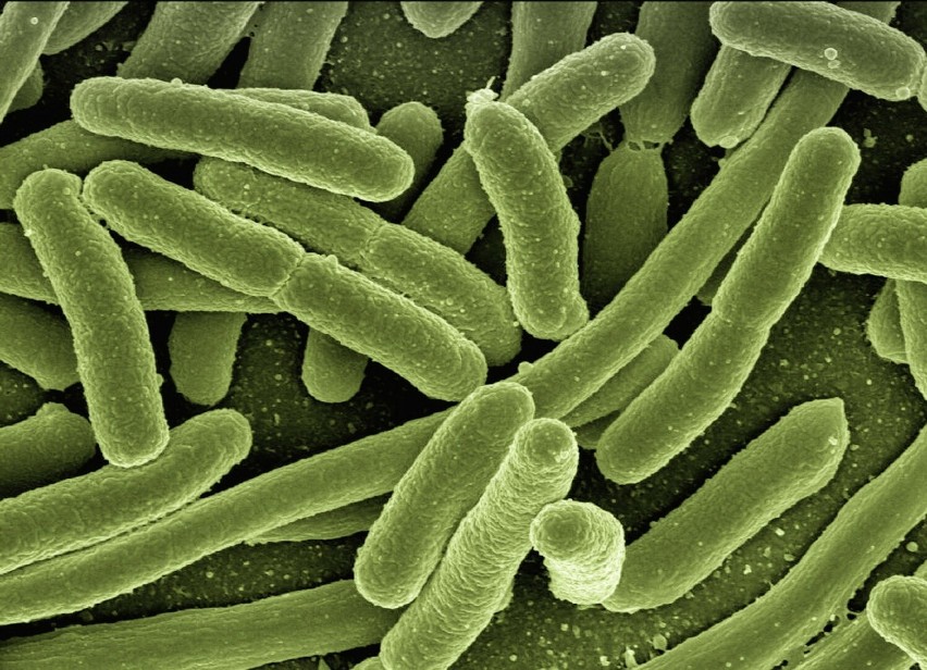 Groźna bakteria E. coli w wodzie. Dostaw pozbawiono 6,5 tys. osób w woj. śląskim. Jak uniknąć zatrucia i groźnych powikłań zakażenia?