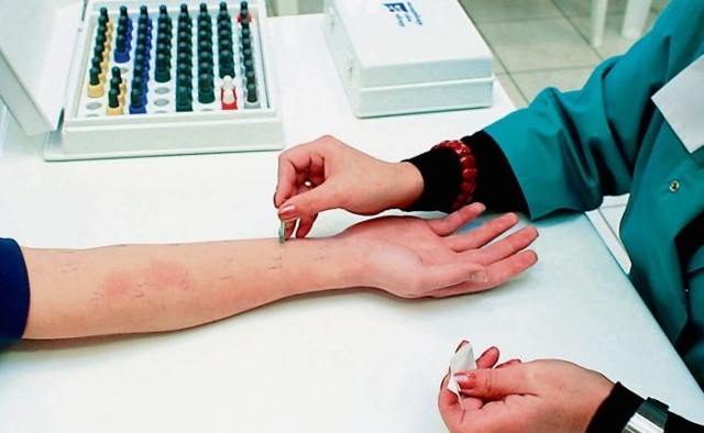 Testy skórne wykonane przez alergologa pokazują, co nas uczula najbardziej