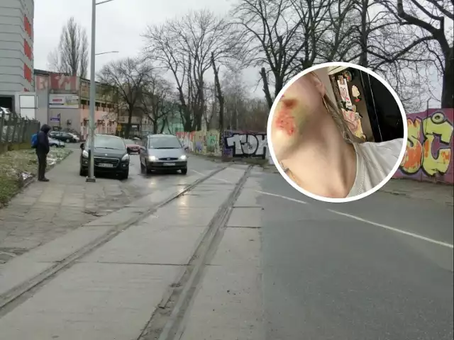 Mieszkanka Radomia wywróciła się na śliskich szynach jadąc rowerem na ulicy Mazowieckiego. Oto skutki wypadku.
