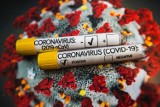 Koronawirus Opolskie. Pięć nowych przypadków COVID-19 w regionie, 285 w Polsce [RAPORT 31.08.2021]