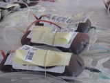 Krwiodawstwo: Szpitale zalegają z rachunkami za krew
