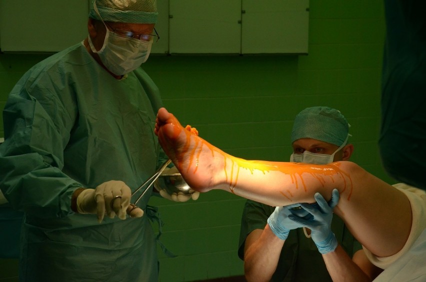 Dwie nowatorskie operacje w szpitalu w Sieradzu [ZDJĘCIA]