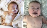 Mały Filipek z Żor potrzebuje pomocy. Tylko kosztowna operacja serca uratuje mu życie!