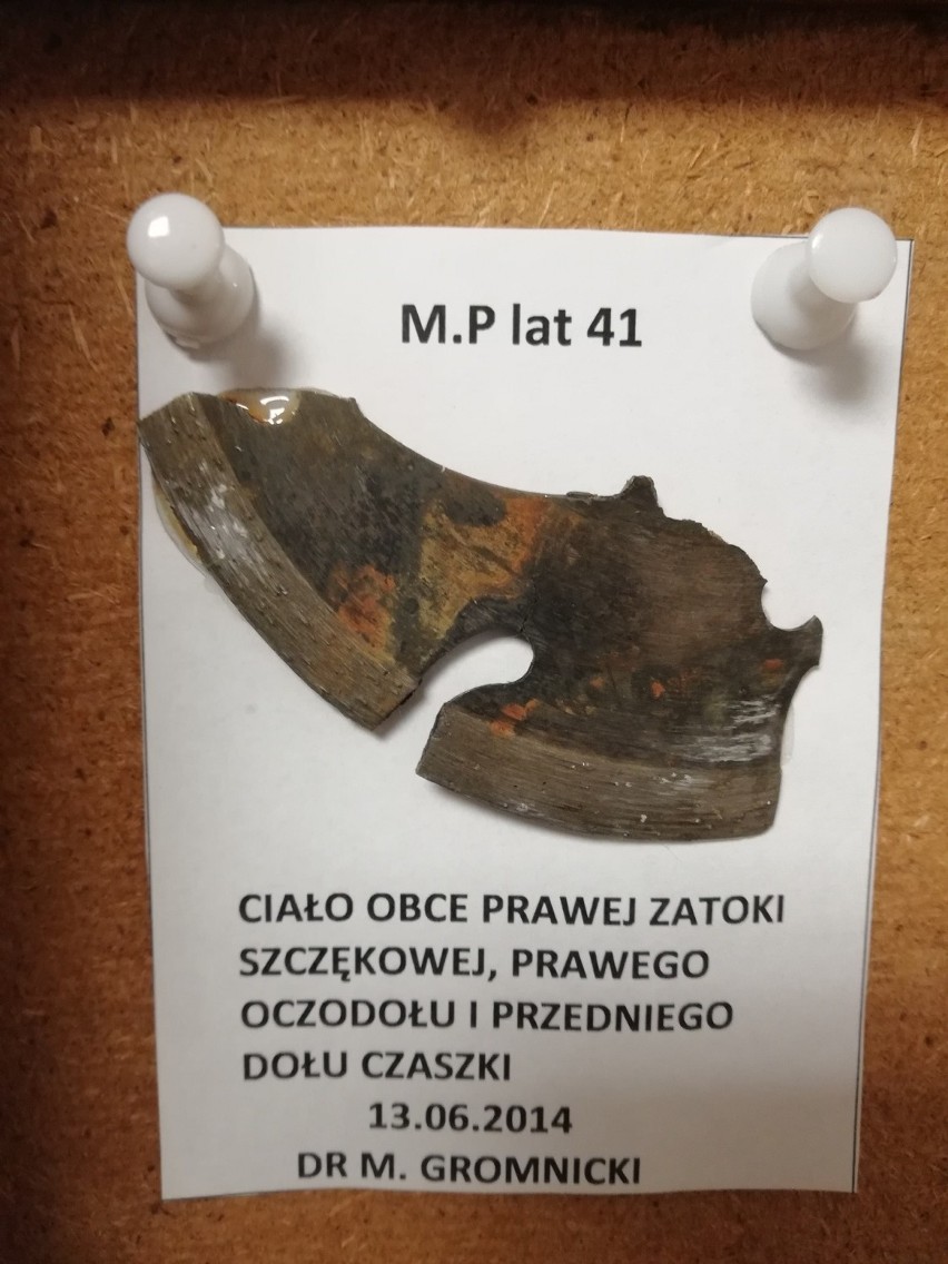 Jak mówi ordynator słupskiego oddziału laryngologii...