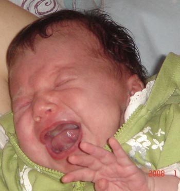 Źródło: http://commons.wikimedia.org/wiki/File:Crying_baby.jpg