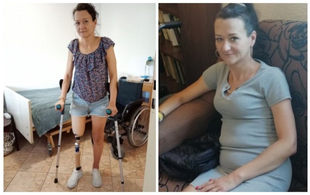 Nowoczesna proteza nogi, która usprawni życie pani Karoliny, kosztuje ok. 50 tys. zł.