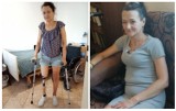 Dzięki nowej protezie mieszkanka Malborka będzie mogła chodzić. Prośba o pomoc i udział w charytatywnej zbiórce