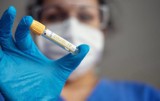 25 nowych zdiagnozowanych przypadków koronawirusa w Wielkopolsce